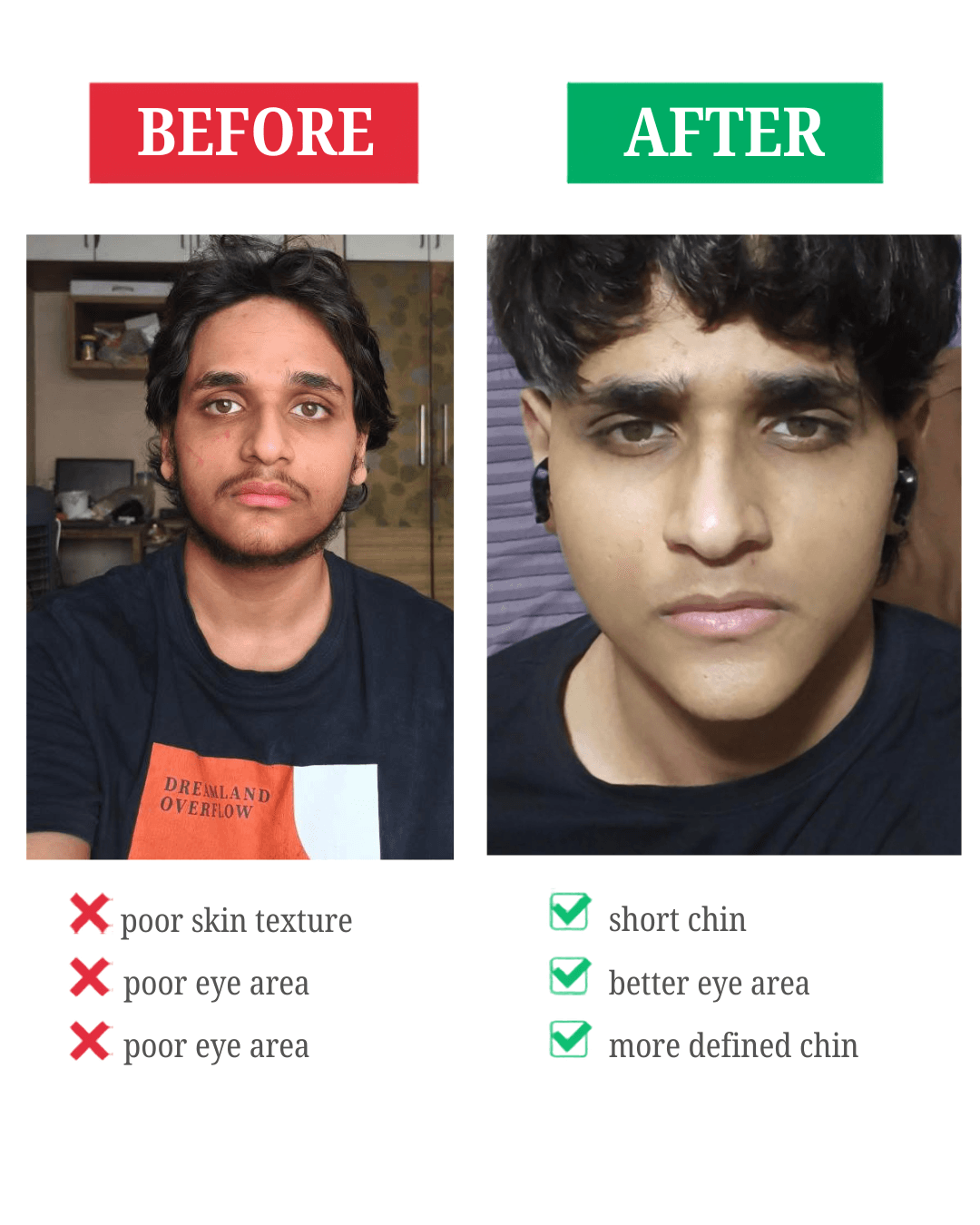 Client before and after transformation showing improved skin, eye area, and facial definition
